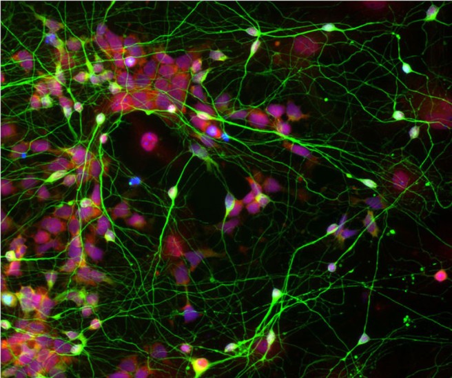 "Human neural stem cells (shown in red), originally reprogrammed from adult skin cells, differentiate efficiently into brain cells (shown in green), after being cultured with star-shaped cells called astrocytes." Photo credit:  Chen Lab, Penn State University via Pen State News