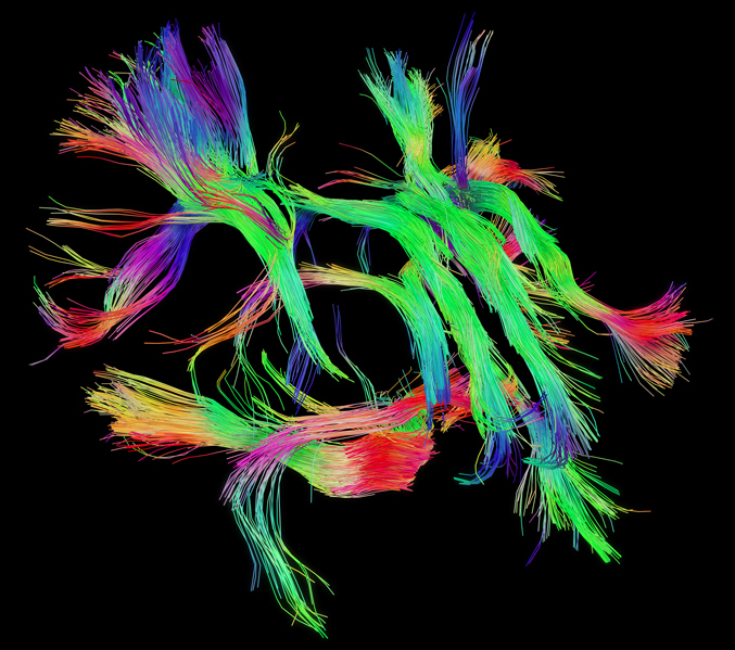 WHITE MATTER FIBER ARCHITECTURE AS SEEN BY THE CONNECTOME SCANNER DATASET
